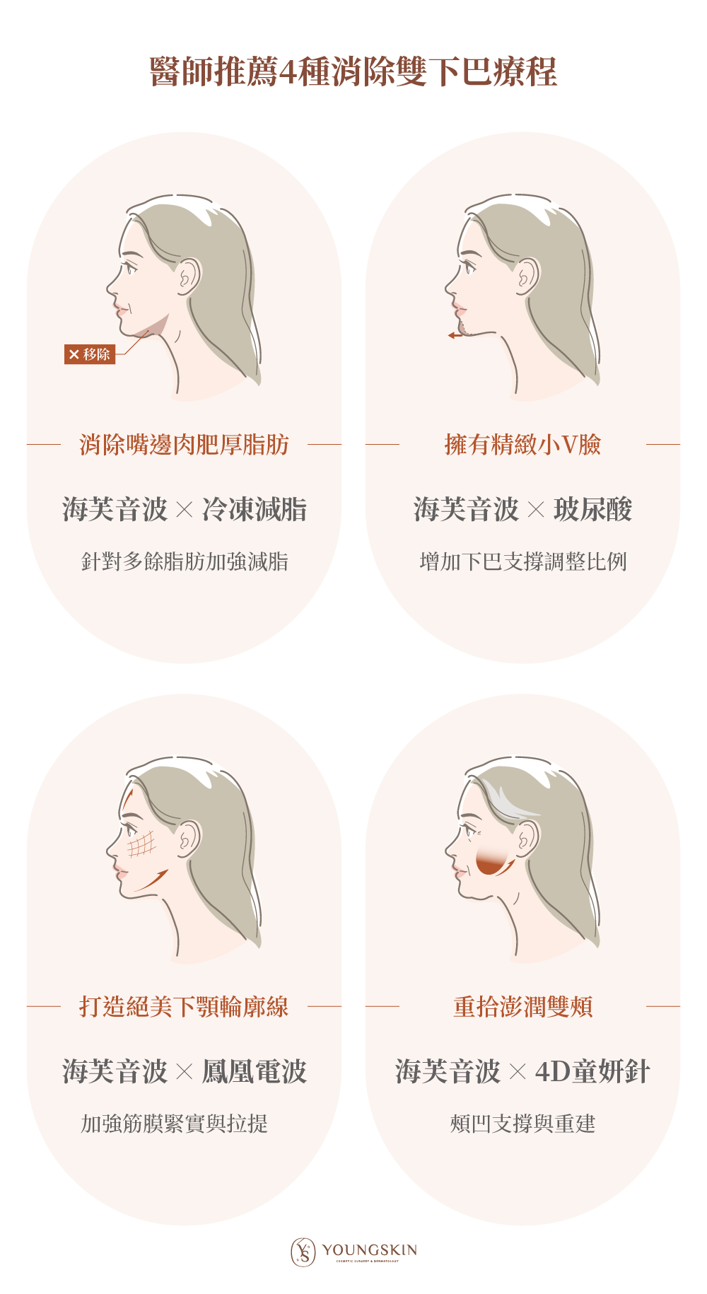 醫師推薦4種消除雙下巴療程